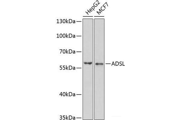 Adenylosuccinate Lyase Antikörper