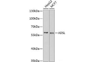 Western blot analysis of extracts of various cell lines using ADSL Polyclonal Antibody at dilution of 1:1000. (Adenylosuccinate Lyase Antikörper)