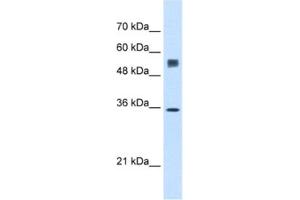 Western Blotting (WB) image for anti-Signal Sequence Receptor, alpha (SSR1) antibody (ABIN2462851) (SSR1 Antikörper)