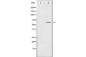 Western blot analysis of Tyrosine Hydroxylase phosphorylation expression in RAW264. (Tyrosine Hydroxylase Antikörper  (pSer40))