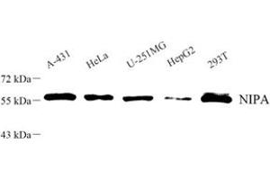 Western blot analysis of NIPA (ABIN7076278) at dilution of 1: 500 (ZC3HC1 Antikörper)