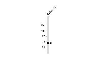 Anti-STT3A Antibody (Center) at 1:2000 dilution + human placenta lysate Lysates/proteins at 20 μg per lane. (STT3A Antikörper  (AA 476-507))