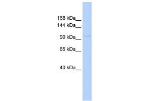 WB Suggested Anti-COL6A1 Antibody Titration:  0. (COL6A1 Antikörper  (Middle Region))