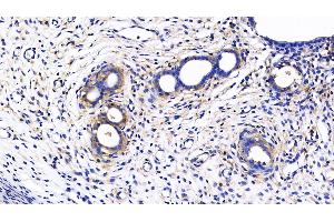 Immunohistochemistry (IHC) image for anti-Matrix Metallopeptidase 7 (Matrilysin, Uterine) (MMP7) (AA 1-267) antibody (ABIN7431020)