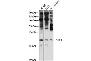 Western blot analysis of extracts of various cell lines, using CSF3 antibody (ABIN6127710, ABIN6139100, ABIN6139101 and ABIN6221772) at 1:1000 dilution. (G-CSF Antikörper  (AA 30-207))