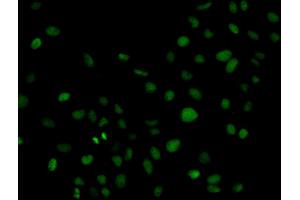 Immunofluorescence analysis of HeLa cell using PLCG2 antibody. (Phospholipase C gamma 2 Antikörper  (AA 1-300))