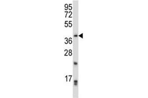PITX2 antibody western blot analysis in CEM lysate. (PITX2 Antikörper  (AA 42-71))
