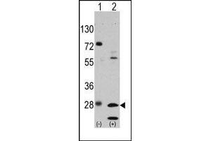 Image no. 1 for anti-Growth Factor Receptor-Bound Protein 2 (GRB2) (Tyr209) antibody (ABIN358793) (GRB2 Antikörper  (Tyr209))
