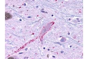 Immunohistochemical staining of Brain (Neurons and glia) using anti- MRGPRF antibody ABIN122237 (Mrgprf Antikörper  (Cytoplasmic Domain))