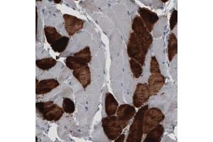 Immunohistochemical staining (Formalin-fixed paraffin-embedded sections) of human skeletal muscle with MYH6 monoclonal antibody, clone CL2162  shows strong cytoplasmic immunoreactivity in a subset of striated muscle fibers. (MYH6 Antikörper)