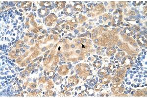 Immunohistochemistry (IHC) image for anti-Tetraspanin 5 (TSPAN5) (Middle Region) antibody (ABIN2782690)