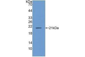 Detection of Recombinant ANP32A, Human using Polyclonal Antibody to Acidic Nuclear Phosphoprotein 32 Family, Member A (ANP32A) (PHAP1 Antikörper  (AA 2-175))