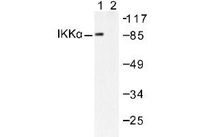 Image no. 1 for anti-conserved Helix-Loop-Helix Ubiquitous Kinase (CHUK) antibody (ABIN265477) (IKK alpha Antikörper)