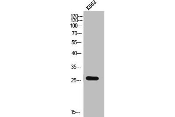 CMTM2 Antikörper  (C-Term)