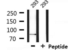 Western blot analysis of extracts from 293, using SENP5 Antibody. (SENP5 Antikörper)