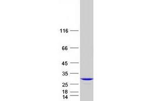 Validation with Western Blot (PCTP Protein (Transcript Variant 1) (Myc-DYKDDDDK Tag))