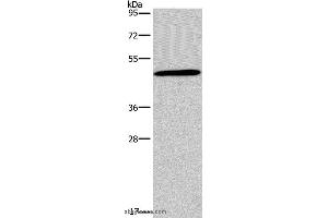 Western blot analysis of 293T cell, using GCGR Polyclonal Antibody at dilution of 1:200