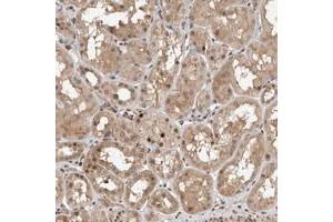 Immunohistochemical staining of human kidney with LEMD3 polyclonal antibody  shows nuclear positivity often accentuated to the membrane in renal tubules. (LEMD3 Antikörper)