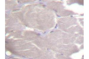 Immunohistochemistry (IHC) analyzes of IKKα/β antibody in paraffin-embedded human skeletal muscle tissue. (IKK alpha Antikörper)