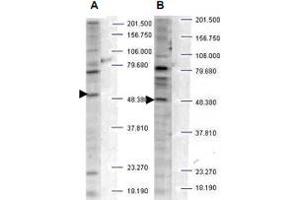 Western blot analysis is shown using SH3BP2 (phospho S427) polyclonal antibody  to detect endogenous protein present in unstimulated human whole cell lysates. (SH3BP2 Antikörper  (pSer427))