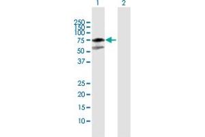 Western Blot analysis of MDM4 expression in transfected 293T cell line by MDM4 MaxPab polyclonal antibody. (MDM4-binding Protein Antikörper  (AA 1-490))
