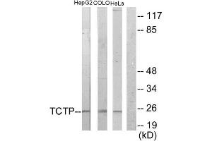 Western Blotting (WB) image for anti-Tumor Protein, Translationally-Controlled 1 (TPT1) (Internal Region) antibody (ABIN1849166)