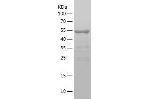Western Blotting (WB) image for Dedicator of Cytokinesis 6 (DOCK6) (AA 1718-1971) protein (His-IF2DI Tag) (ABIN7122612) (DOCK6 Protein (AA 1718-1971) (His-IF2DI Tag))