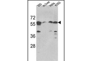 Western blot analysis of hSPTLC1-S41 (ABIN389108 and ABIN2839298) in 293, Hela, K562 cell line and mouse liver tissue lysates (35 μg/lane). (SPTLC1 Antikörper  (N-Term))