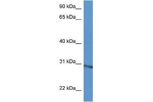 WB Suggested Anti-Rpl5 Antibody Titration: 1. (RPL5 Antikörper  (C-Term))