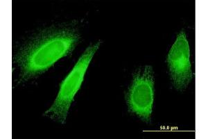 Immunofluorescence of monoclonal antibody to STAU1 on HeLa cell. (STAU1/Staufen Antikörper  (AA 401-496))