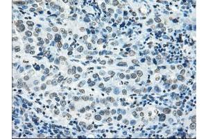 Image no. 16 for anti-P450 (Cytochrome) Oxidoreductase (POR) antibody (ABIN1497746) (POR Antikörper)