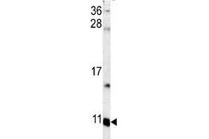 Western blot analysis of S100A6 antibody and mouse lung tissue lysate.