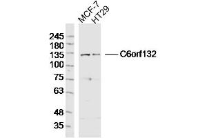 Lane 1: MCF-7 lysates Lane 2: HT29 lysates probed with C6orf132 Polyclonal Antibody, Unconjugated  at 1:300 dilution and 4˚C overnight incubation. (C6ORF132 Antikörper  (AA 1001-1188))