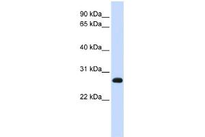 WB Suggested Anti-SNAP23 Antibody Titration:  0. (SNAP23 Antikörper  (N-Term))