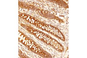Immunohistochemical analysis of (ABIN653144 and ABIN2842716) on paraffin-embedded human appendix tissue was performed on the Leica®BOND RXm. (FCGR1B Antikörper  (C-Term))