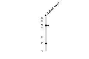 Western blot analysis of lysate from human skeletal muscle tissue lysate, using C4orf18 Antibody (Center) (ABIN657887 and ABIN2846841). (FAM198B Antikörper  (AA 275-304))