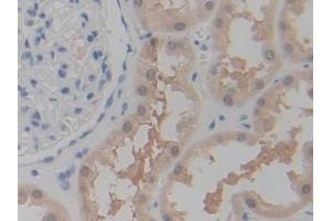 DAB staining on IHC-P; Samples: Human Kidney Tissue (P2RX7 Antikörper  (AA 47-334))