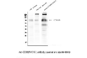 Anti-CD68 antibody, Western blotting Lane 1: Rat Spleen Tissue Lysate Lane 2: Mouse Spleen  Tissue Lysate Lane 3: Mouse RAW246.