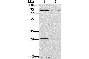 Western blot analysis of Mouse kidney and brain tissue, using CNGA3 Polyclonal Antibody at dilution of 1:500 (CNGA3 Antikörper)