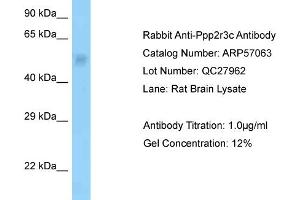 Western Blotting (WB) image for anti-Protein Phosphatase 2, Regulatory Subunit B'', gamma (PPP2R3C) (N-Term) antibody (ABIN2787044)