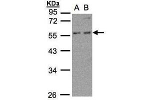 WB Image Sample (30μg whole cell lysate) A:MOLT4 , B:Raji , 10% SDS PAGE antibody diluted at 1:500 (PFKFB4 Antikörper)