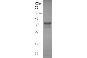 Cyclin A Protein (AA 144-264) (His-IF2DI Tag)
