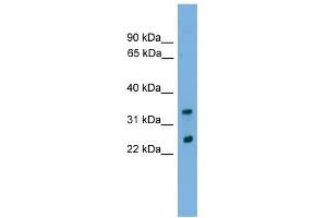 WB Suggested Anti-CHMP4B Antibody Titration: 0. (CHMP4B Antikörper  (Middle Region))