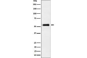 Western blot analysis of PRD expression in HepG2 cell lysate. (Rekombinanter Primary Retinal Dysplasia (PRD) Antikörper)