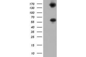 Western Blotting (WB) image for anti-Butyrophilin, Subfamily 1, Member A1 (BTN1A1) antibody (ABIN1496991) (BTN1A1 Antikörper)