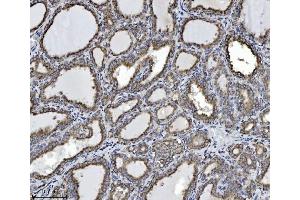 IHC analysis of SCA2/ATXN2 using anti-SCA2/ATXN2 antibody (ABIN7599900).
