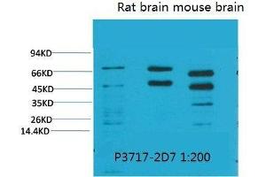 Western Blot (WB) analysis of 1) HeLa, 2)Rat Brain Tissue, 3) Mouse Brain Tissue with Phosphoserine Mouse Monoclonal Antibody diluted at 1:2000. (Phosphoserine Antikörper  (phosphorylated))