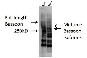 Western blot analysis of Mouse, Rat brain cell lysates showing detection of Bassoon protein using Rabbit Anti-Bassoon Polyclonal Antibody . (Bassoon Antikörper  (AA 786-1041) (PerCP))