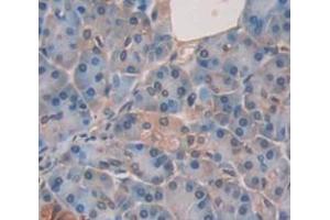 IHC-P analysis of Human Tissue, with DAB staining. (Dystrobrevin beta Antikörper  (AA 1-249))