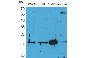 Western Blot (WB) analysis of 22RV-1, H460, U87, Mouse Brain cells using Apelin Polyclonal Antibody. (Apelin Antikörper  (C-Term))